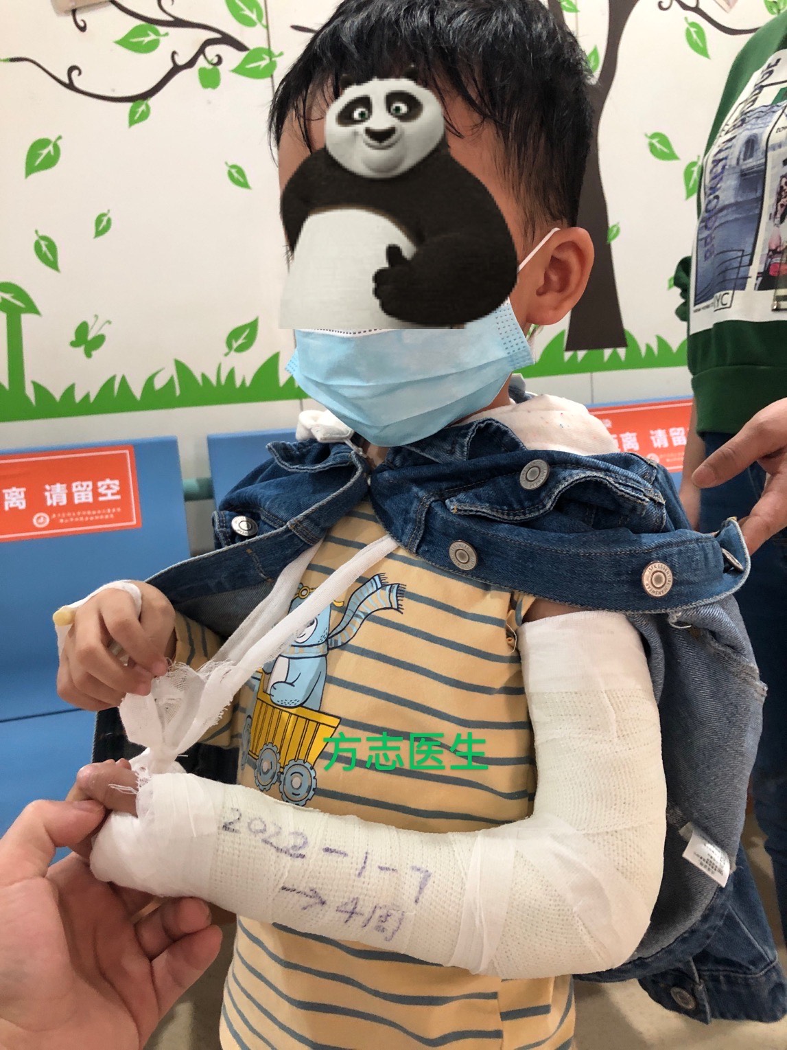 妙手回春！医者仁心，令人惊叹的复位手术治愈六岁骨折萌娃