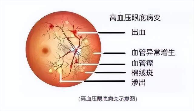 黄斑病变最新有效治疗方法揭秘，小巷深处的秘密小店探索