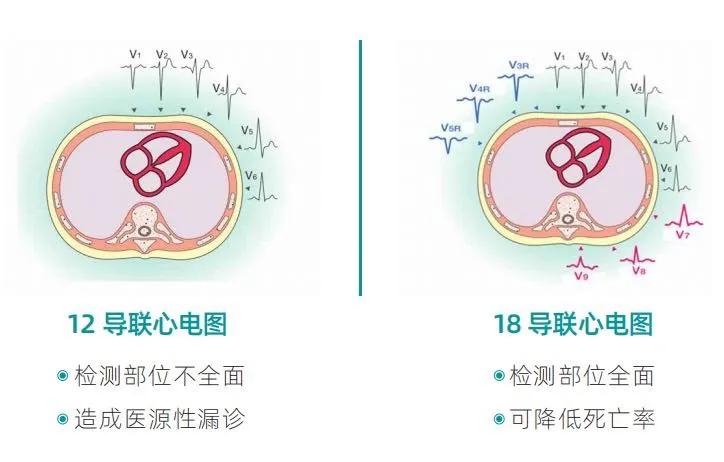 苹果12，科技与设计的最新革新之旅